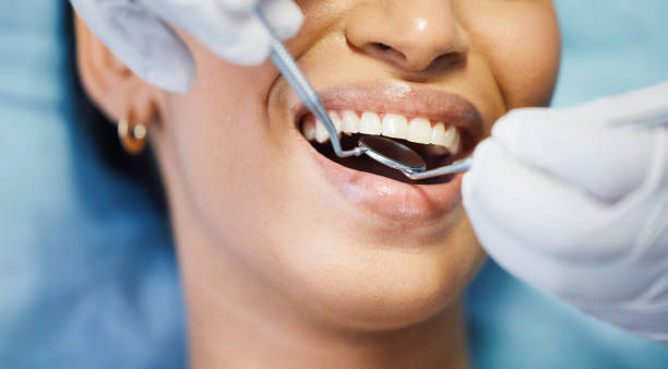 Best Emergency Tooth Extraction in Oak View, CA